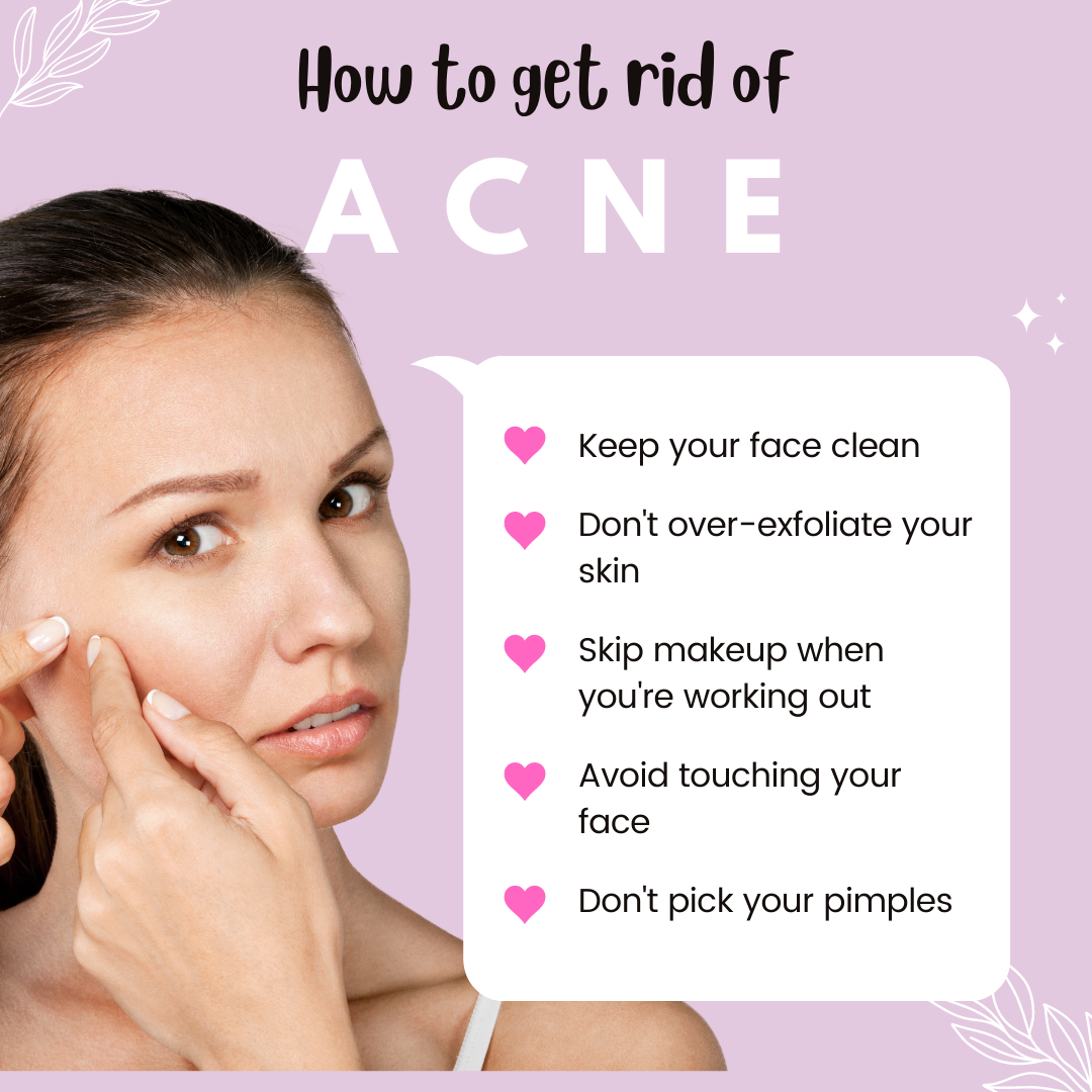 acne scars, types, causes, treatment