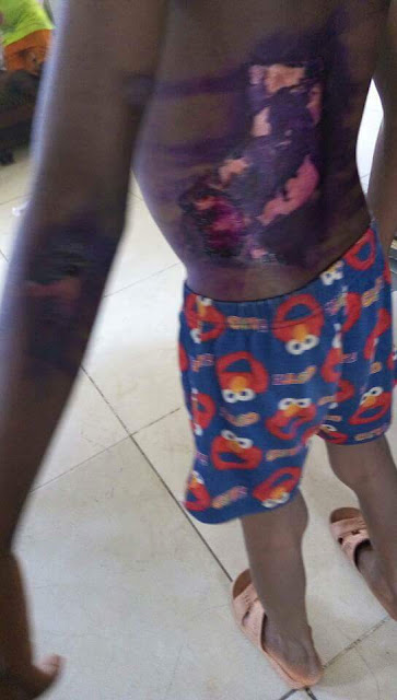 Photos: Man arrested in Abuja for burning 7-year-old son with hot pressing iron over food