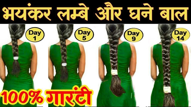 Ayurvedic Hair Loss Treatment in adersh nagar delhi