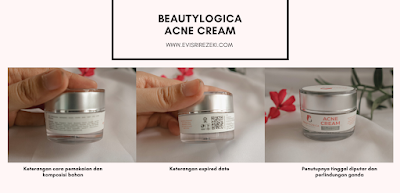 Review-Beautylogica-Clinic-Acne-Package