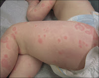 Risultati immagini per orticARIA