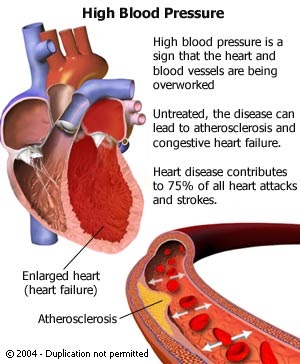 SANDAKAN MAGIC: Manfaat CoQ10 Untuk Kesihatan Jantung 