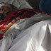 Afghan woman's ears cut off by husband