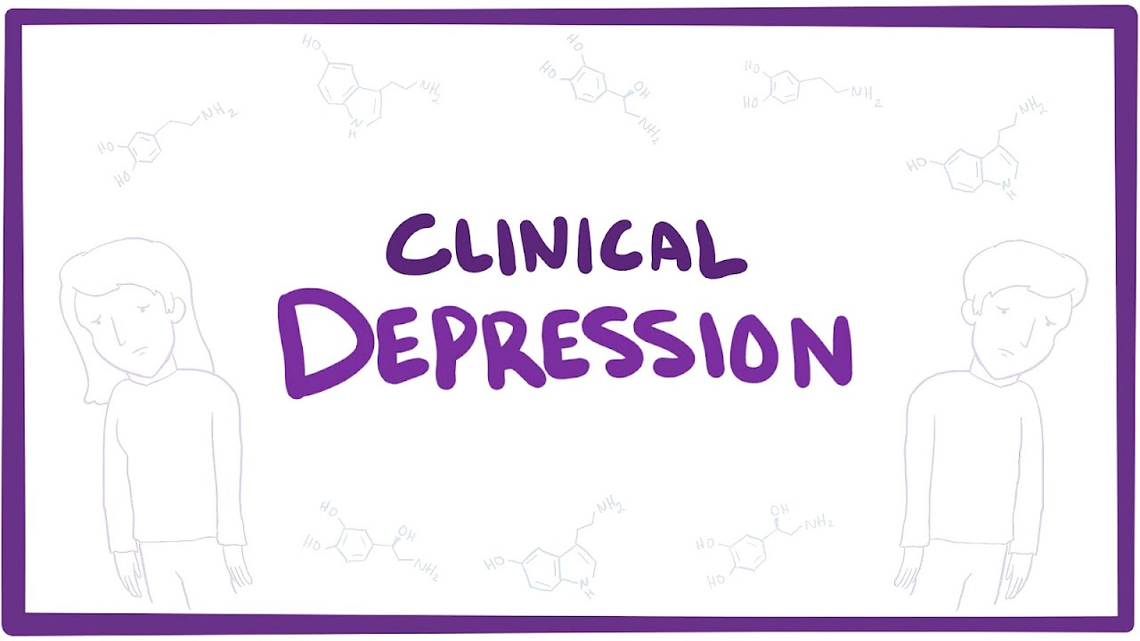 Signs Of Acute Depression
