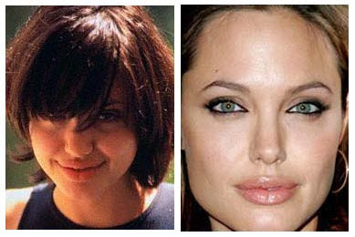 Angelina Jolie Nose Job