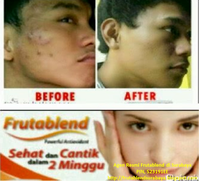 Stokis Frutablend Mojokerto