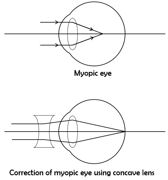 Question 2 picture