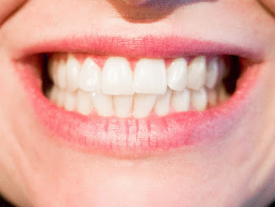 dental treatment ideas