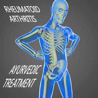 rheumatoid-arthritis-ayurvedic-teatment