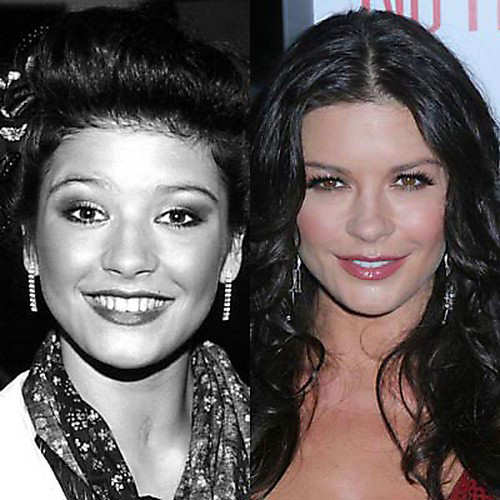 plastic surgery before and after celebrities