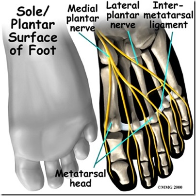 foot_neuroma_anat01