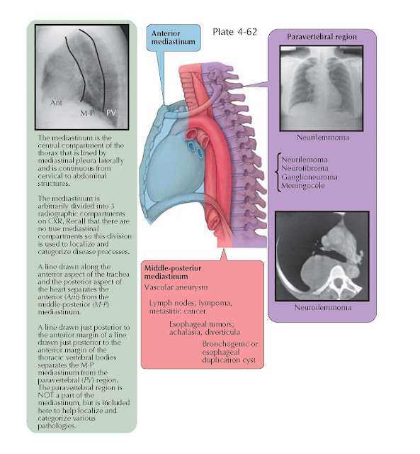 MIDDLE-POSTERIOR AND PARAVERTEBRAL MEDIASTINUM