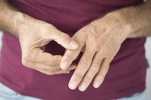 Rheumatoid Arthritis Treatment