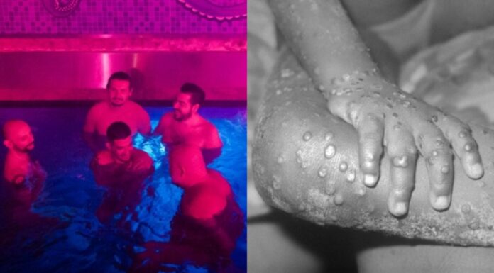 Ditutup! Sauna Gay di Spanyol Diduga Jadi Penyebab Penyebaran Cacar Monyet