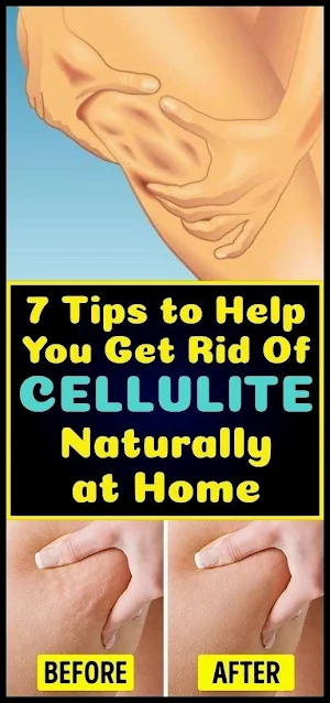 7 Tips to reduce cellulite naturally at home