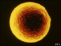 Photo of a Human Egg