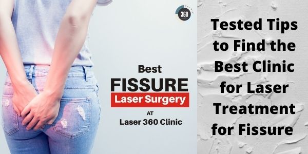 Laser Treatment For Fissure In Delhi