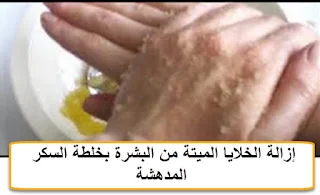 إزالة الخلايا الميتة