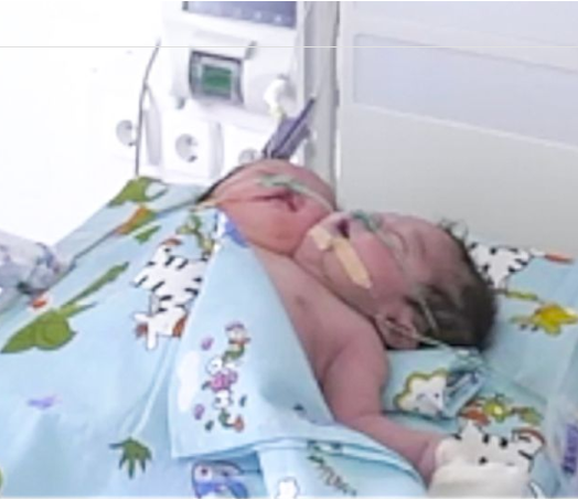 Doctors baffled as rare two-headed baby is born in Uzbekistan