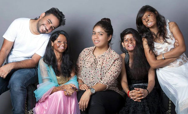 #Acid Attack Survivor- फिल्मी नहीं होती कुछ कहानियां 