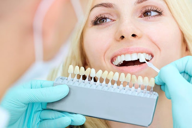 Blanqueamiento dental