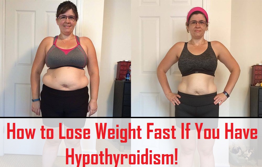 How to Lose Weight Fast If You Have Hypothyroidism?