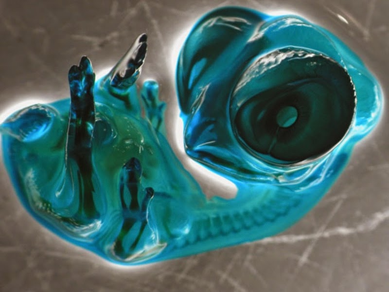 16 Terryfying Images From The Microscope - Chicken embryo