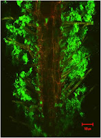 a plant fighting a bacteria