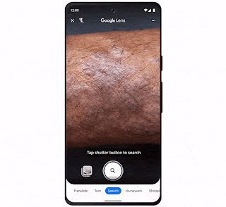 Google Lens Enhances Skin Condition Detection