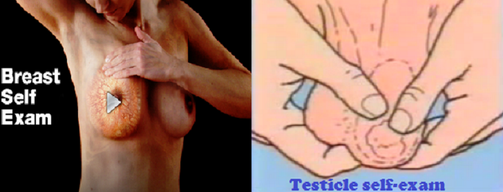 Breast Self-Exam for Women and Testicle Self-Exam for Men