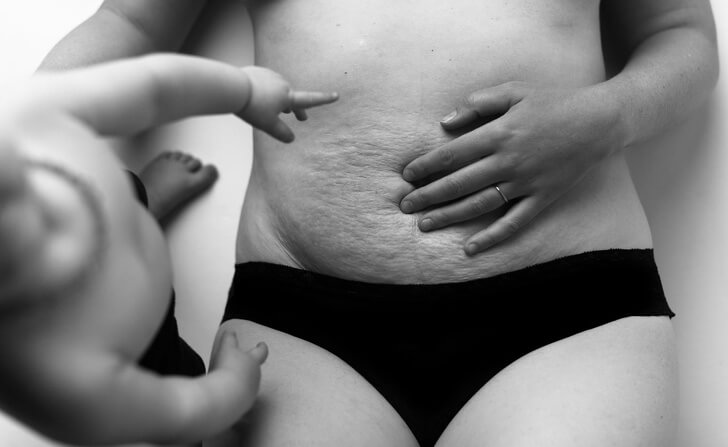 A Photographer Shows How Female Bodies Truly Look Like After Pregnancy