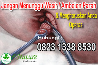 obat-wasir-berdarah-paling-bagus-laris-di-apotik-sangat-ampuh