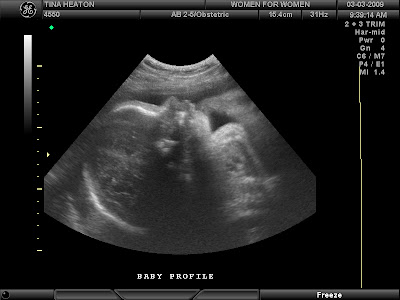 I am in my 29 week or just
