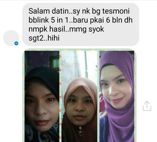 testimoni babies blink 