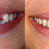 Chăm sóc răng miệng đúng cách cho hàm răng đẹp