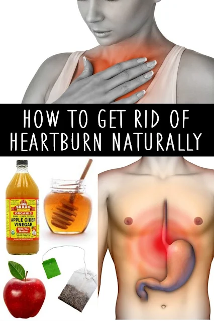 Heartburn: Trigger Foods to Avoid and 6 Natural Ways to Get Rid of It