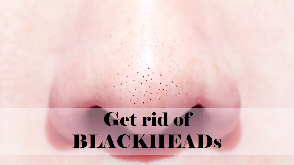 How to Get rid of Blackheads