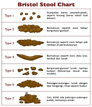 Gaya Terbaru 84+ Macam Macam Warna Feses Bayi Dan Penyebabnya