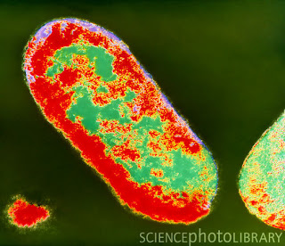 hasananalis Shigella disentriae