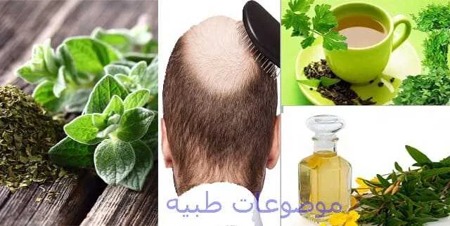 علاج تساقط الشعر بالاعشاب للرجال