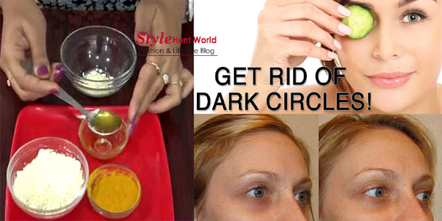 Top 6 Easy Home Remedies to Get Rid of Dark Circles Permanently