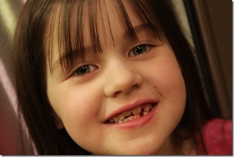 KyliesLostTooth-2