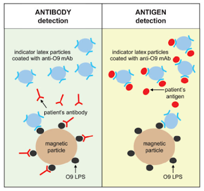 Kerja Tes Tubex dalam Mendeteksi Antibodi atau Antigen