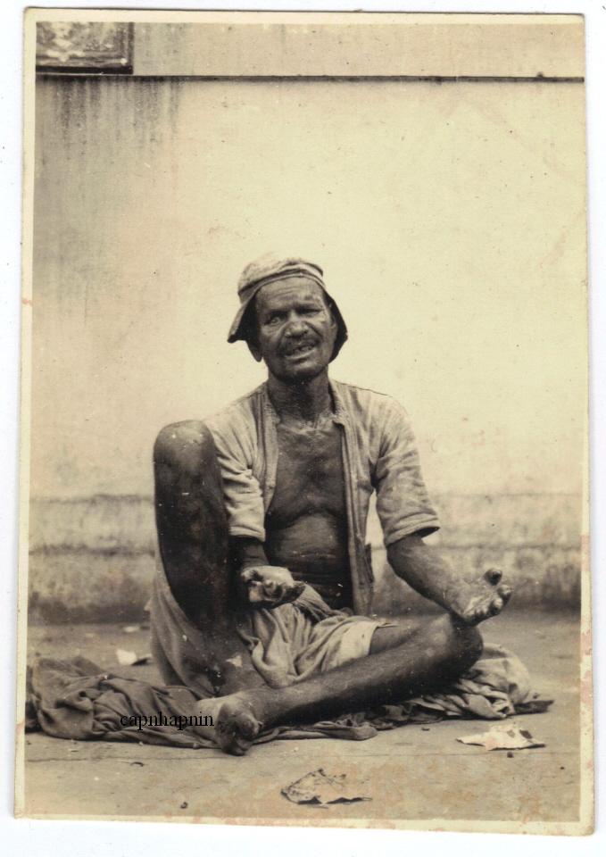 Leper Man Begging -  India 1930's