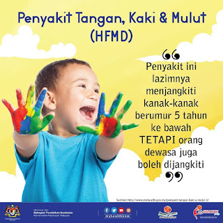 tips atasi penyakit HFMD