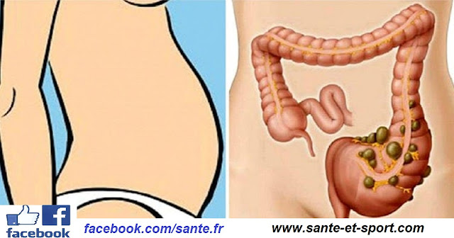 Perdre du poids : une recette naturelle pour dégonfler le ventre des gaz intestinal.