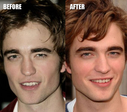 Plastic Surgery Before And After