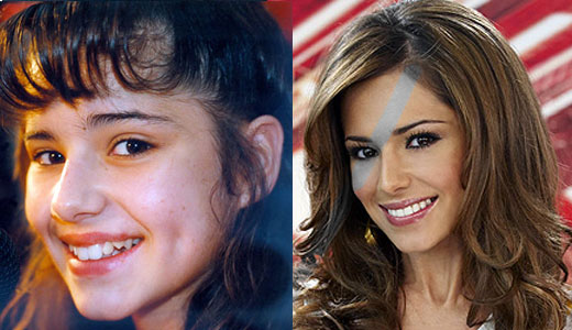 Before And After Celebrity Teeth. look like efore they got