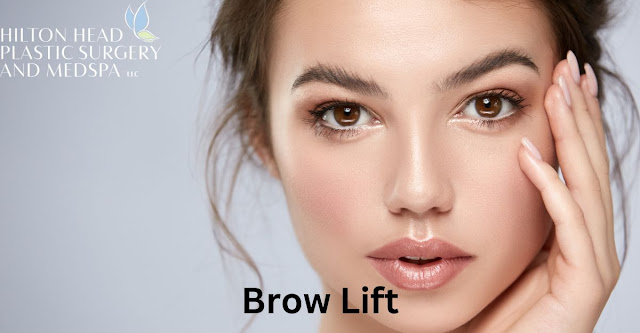 Brow Lift