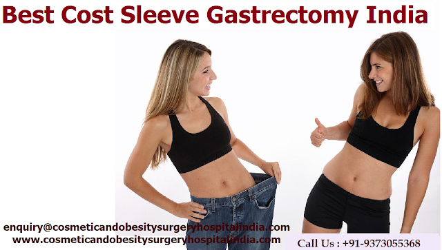 Cost Effective Sleeve Gastrectomy